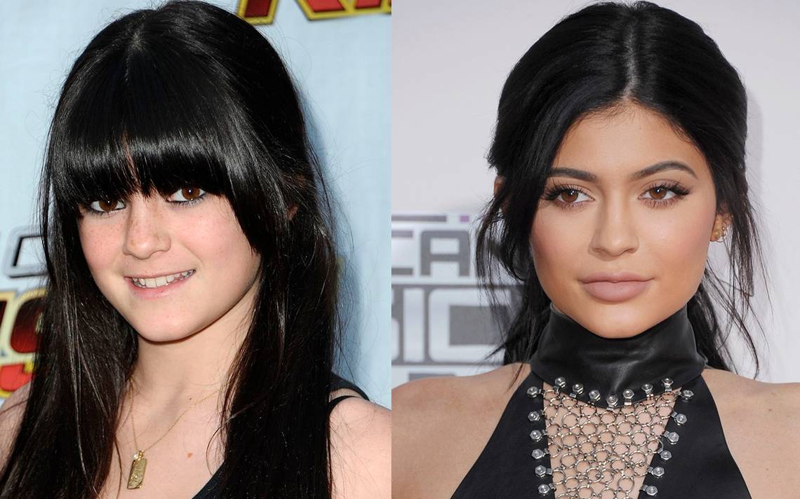 Solo maquillaje y peinado; Kylie Jenner se deslinda de operaciones - El Sol  de México | Noticias, Deportes, Gossip, Columnas